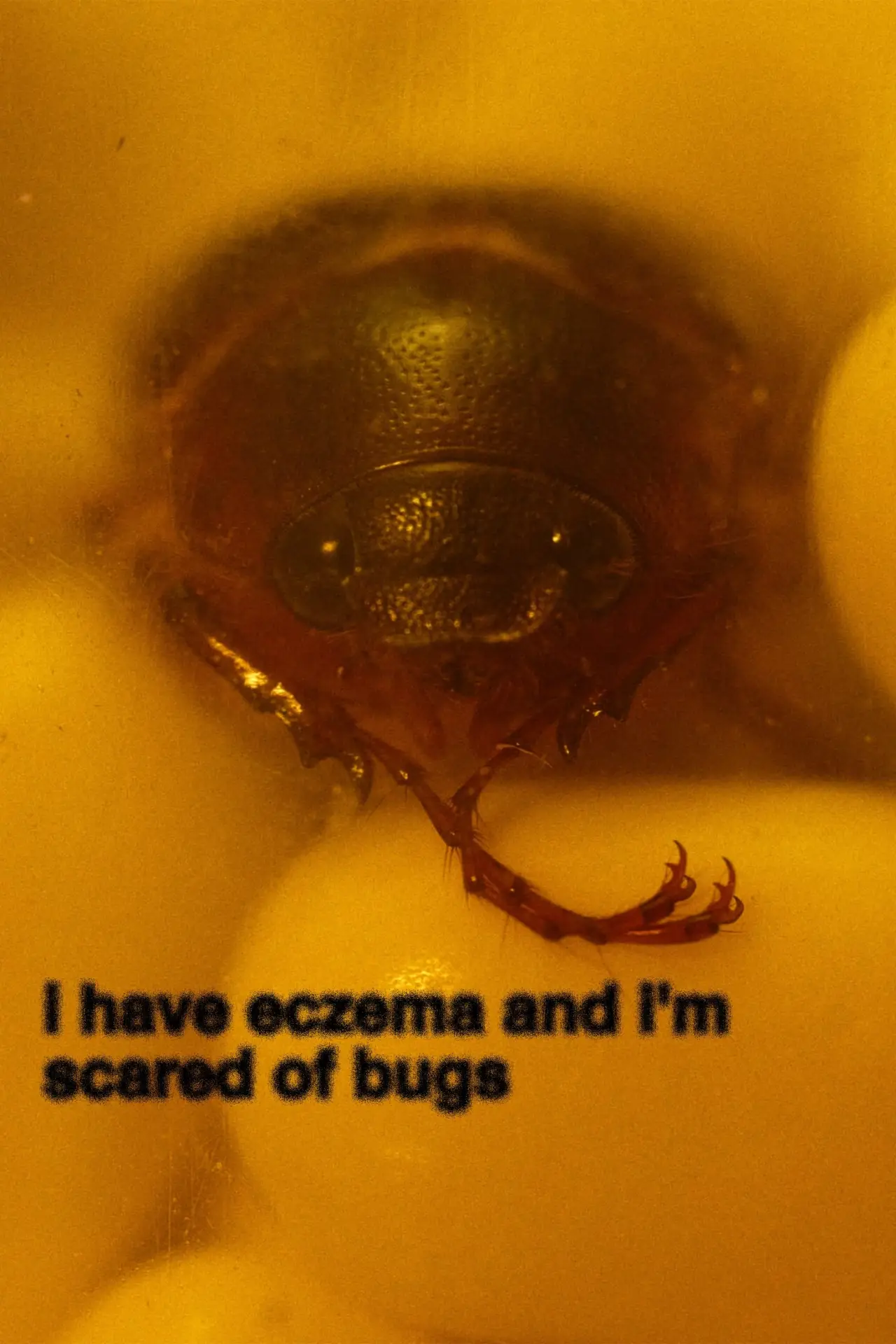 Movie poster "i have eczema and i