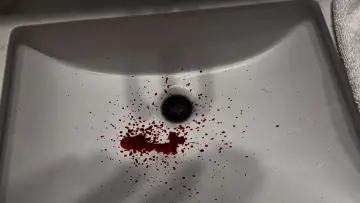 Backdrop to the movie "Bloody Nose" #1144432