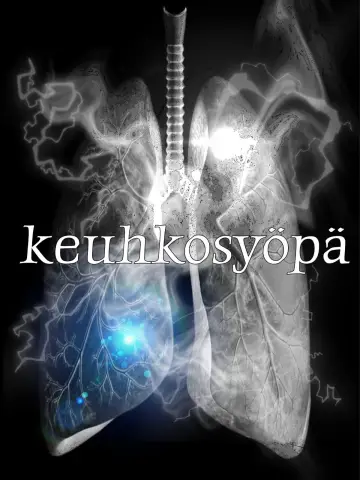 Poster to the movie "keuhkosyöpä" #1184671