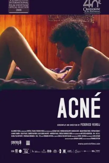 Poster to the movie "Acne" #1171126