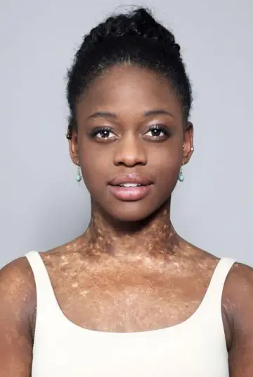 Photo Michaela DePrince #429781