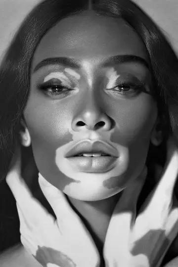 Photo Winnie Harlow #155994