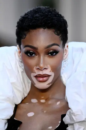 Photo Winnie Harlow #330231