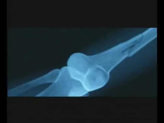 Video for the film Fragile — Fragile - Trailer Italiano (2005)