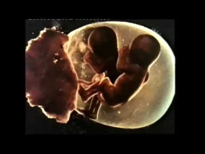 Video for the film Sisters — Sisters (1973) - Trailer
