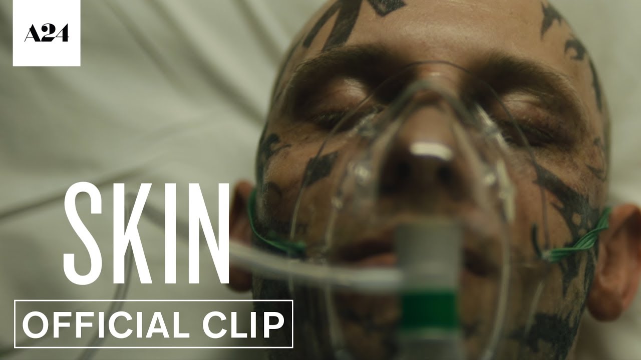 Video for the film Skin — In the Hospital
