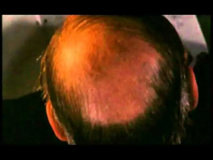 Video for the film A Cat in the Brain — Un Gatto nel Cervello (Trailer Italiano)